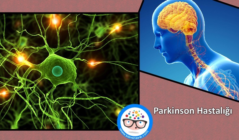 Parkinson Hastalığı Nedir Belirtileri Ve Tedavisi Biliminsesi Sağlık Ve Teknoloji 4409